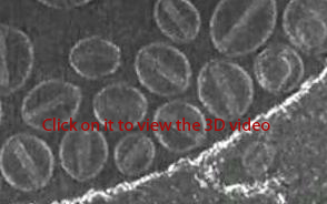 ( Click to enjoy this amazing 3D video of Cryo-TEM of STEALTH liposomal doxorubicin producted by FormuMax and Image taken by Nano Imaging Services) FormuMax_liposome_doxorubicin_3D_Video.jpg